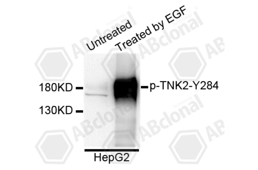 Western Blot - Anti-TNK2 (phospho Y284) Antibody (AP0589) - Antibodies.com