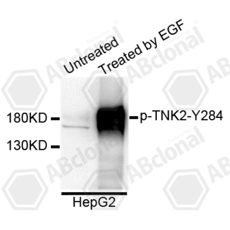 Western Blot - Anti-TNK2 (phospho Y284) Antibody (AP0589) - Antibodies.com
