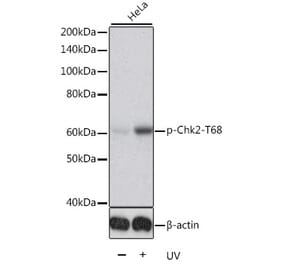 Western Blot - Anti-Chk2 (phospho Thr68) Antibody (A11068) - Antibodies.com
