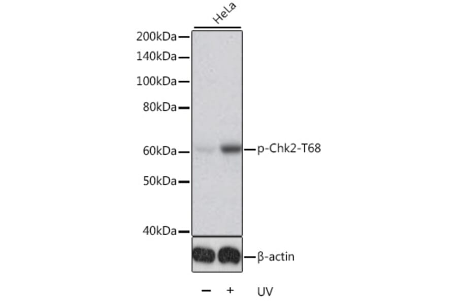 Western Blot - Anti-Chk2 (phospho Thr68) Antibody (A11068) - Antibodies.com