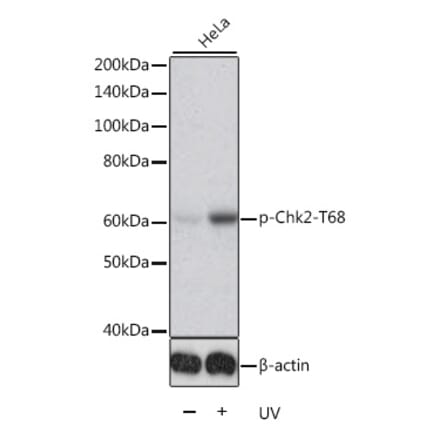 Western Blot - Anti-Chk2 (phospho Thr68) Antibody (A11068) - Antibodies.com