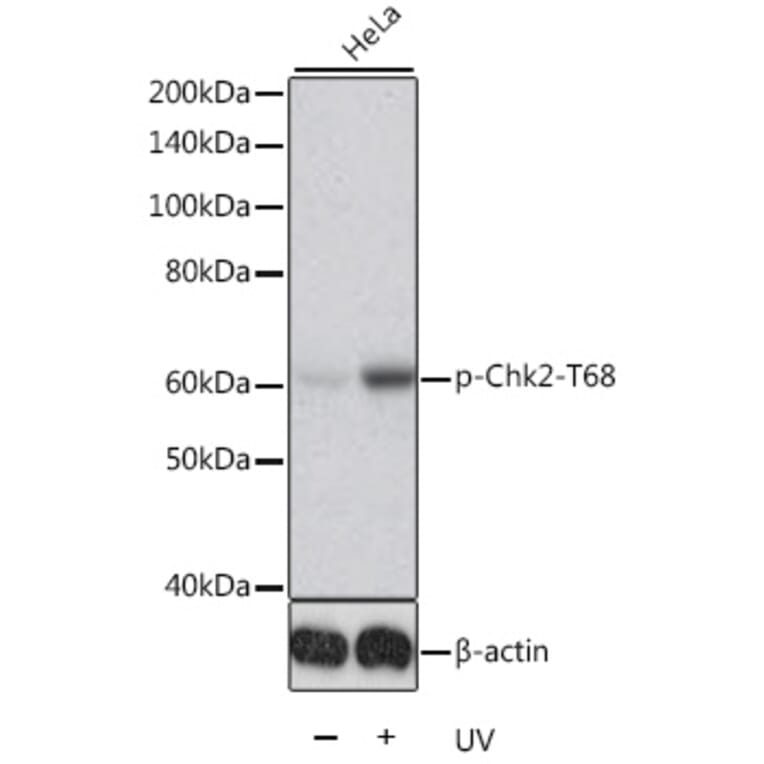 Western Blot - Anti-Chk2 (phospho Thr68) Antibody (A11068) - Antibodies.com
