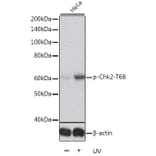 Western Blot - Anti-Chk2 (phospho Thr68) Antibody (A11068) - Antibodies.com