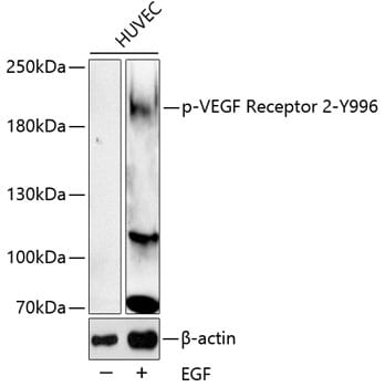 Western blot analysis of extracts of HUVEC cell line, using Anti-VEGFR2 (phospho Y996) Antibody (AP0595).
Secondary antibody: Goat Anti-Rabbit IgG (H+L) (HRP) (AS014) at 1:10,000 dilution.
Lysates / proteins: 25µg per lane.
Blocking buffer: 3% BSA.