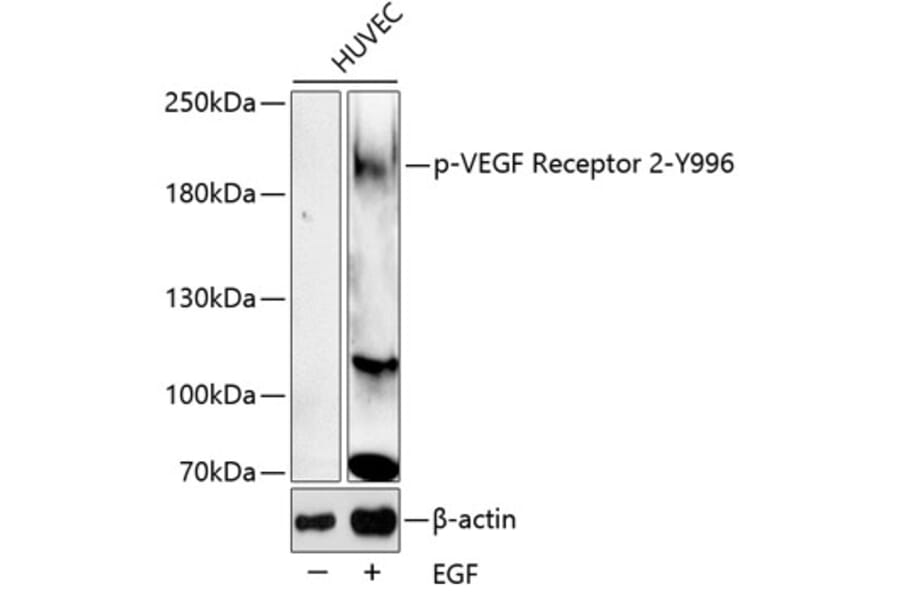 Western Blot - Anti-VEGF Receptor 2 (phospho Tyr996) Antibody (A11071) - Antibodies.com