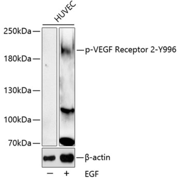 Western Blot - Anti-VEGF Receptor 2 (phospho Tyr996) Antibody (A11071) - Antibodies.com