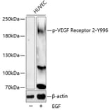 Western Blot - Anti-VEGF Receptor 2 (phospho Tyr996) Antibody (A11071) - Antibodies.com