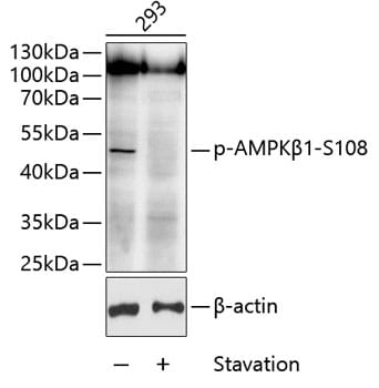 Western blot analysis of extracts of 293 cells, using Anti-AMPKβ1 (phospho S108) Antibody (AP0597) at 1:1,000 dilution.
Secondary antibody: Goat Anti-Rabbit IgG (H+L) (HRP) (AS014) at 1:10,000 dilution.
Lysates / proteins: 25µg per lane.
Blocking buffer: 3% BSA.