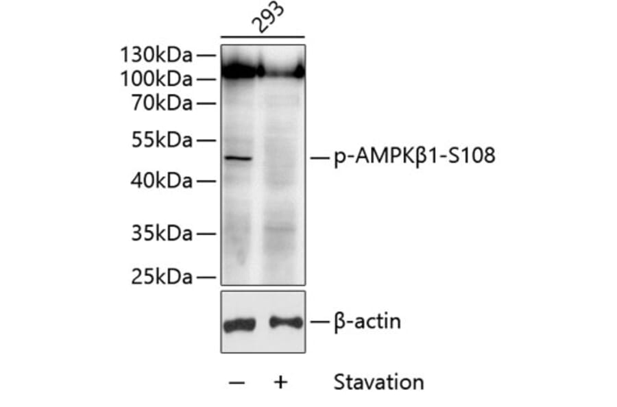 Western Blot - Anti-AMPK beta 1 (phospho Ser108) Antibody (A11073) - Antibodies.com