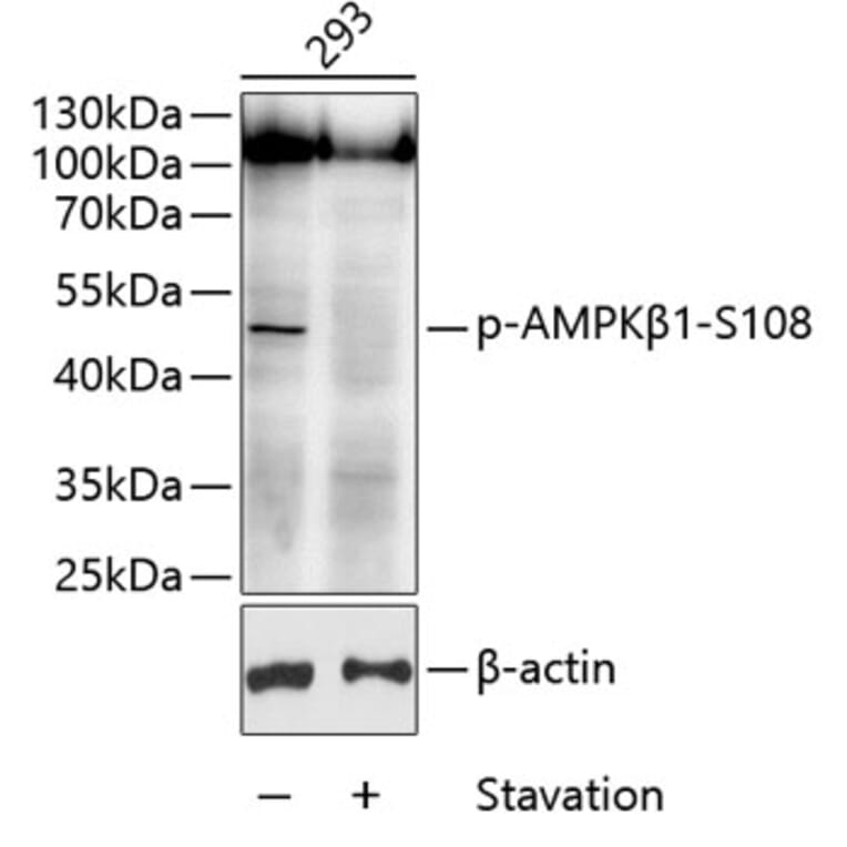 Western Blot - Anti-AMPK beta 1 (phospho Ser108) Antibody (A11073) - Antibodies.com