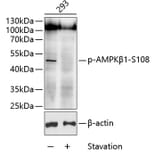 Western Blot - Anti-AMPK beta 1 (phospho Ser108) Antibody (A11073) - Antibodies.com