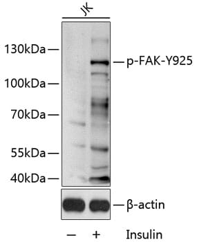 Western blot analysis of extracts of Jurkat cell line, using Anti-PTK2 (phospho Y925) Antibody (AP0599) 1:1000 dilution.
Secondary antibody: Goat Anti-Rabbit IgG (H+L) (HRP) (AS014) at 1:10,000 dilution.
Lysates / proteins: 25µg per lane.
Blocking buffer: 3% BSA.