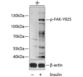 Western Blot - Anti-FAK (phospho Tyr925) Antibody (A11075) - Antibodies.com