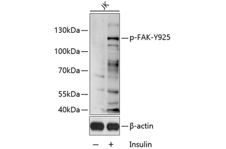 Western Blot - Anti-FAK (phospho Tyr925) Antibody (A11075) - Antibodies.com