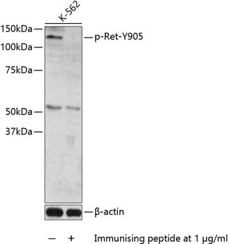 Western blot analysis of extracts of K562 cells, using Anti-Ret (phospho Y905) Antibody (AP0600).
Secondary antibody: Goat Anti-Rabbit IgG (H+L) (HRP) (AS014) at 1:10,000 dilution.
Lysates / proteins: 25µg per lane.
Blocking buffer: 3% BSA.
