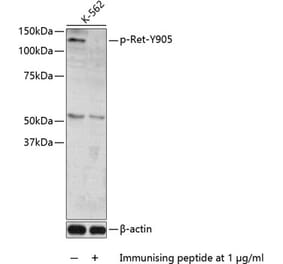 Western Blot - Anti-Ret (phospho Tyr905) Antibody (A11076) - Antibodies.com