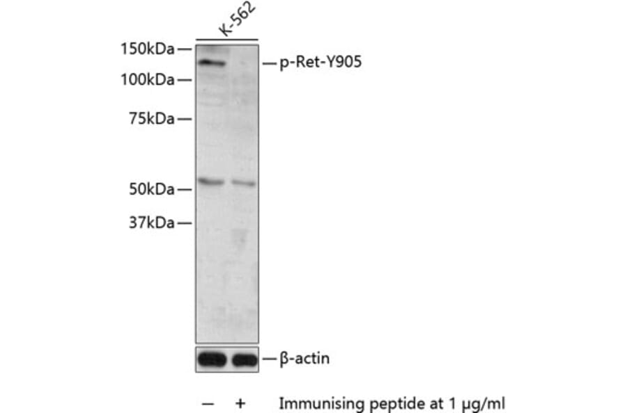 Western Blot - Anti-Ret (phospho Tyr905) Antibody (A11076) - Antibodies.com