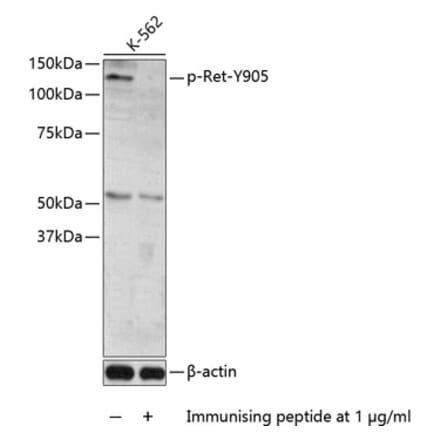 Western Blot - Anti-Ret (phospho Tyr905) Antibody (A11076) - Antibodies.com