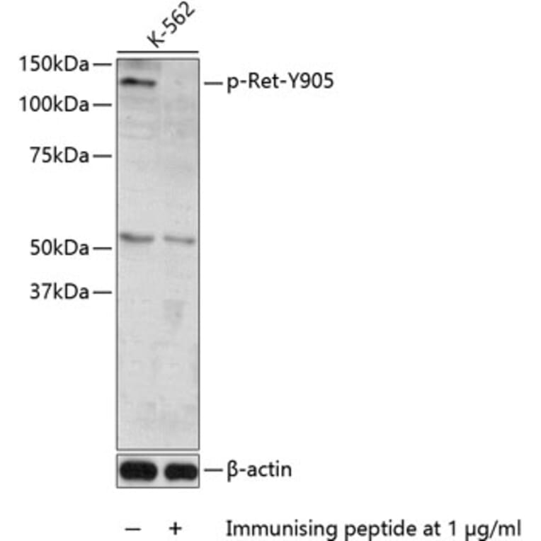 Western Blot - Anti-Ret (phospho Tyr905) Antibody (A11076) - Antibodies.com