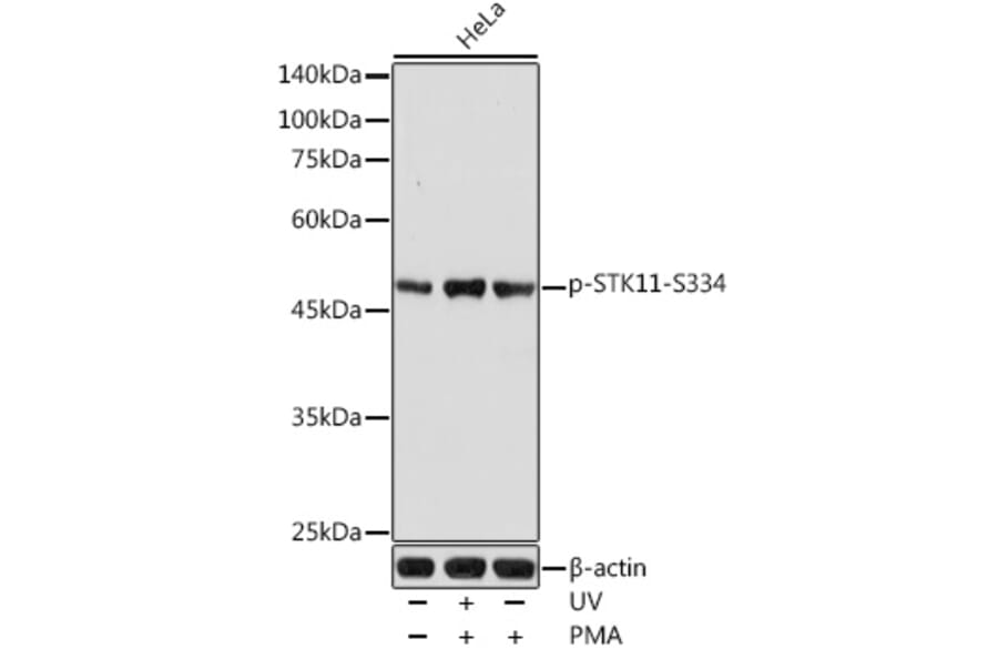 Western Blot - Anti-LKB1 (phospho Ser334) Antibody (A11077) - Antibodies.com