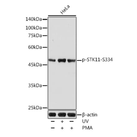 Western Blot - Anti-LKB1 (phospho Ser334) Antibody (A11077) - Antibodies.com