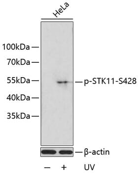 Western blot analysis of extracts of HeLa cells, using Anti-STK11 (phospho S428) Antibody (AP0602).
Secondary antibody: Goat Anti-Rabbit IgG (H+L) (HRP) (AS014) at 1:10,000 dilution.
Lysates / proteins: 25µg per lane.
Blocking buffer: 3% BSA.