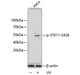 Western Blot - Anti-LKB1 (phospho Ser428) Antibody (A11078) - Antibodies.com