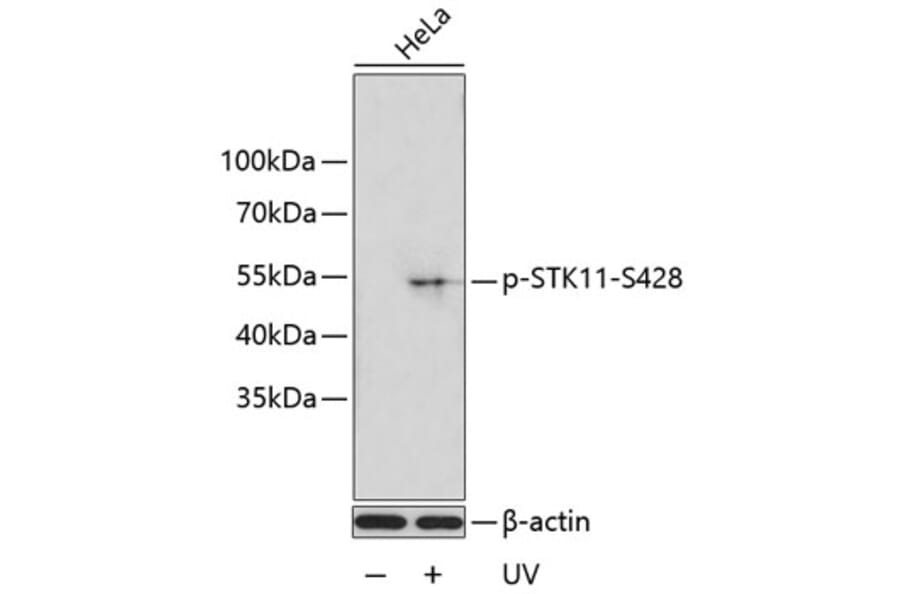Western Blot - Anti-LKB1 (phospho Ser428) Antibody (A11078) - Antibodies.com