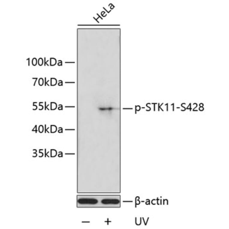 Western Blot - Anti-LKB1 (phospho Ser428) Antibody (A11078) - Antibodies.com