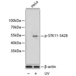 Western Blot - Anti-LKB1 (phospho Ser428) Antibody (A11078) - Antibodies.com
