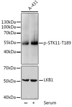 Western blot analysis of extracts of A431 cells, using Anti-STK11 (phospho T189) Antibody (AP0603) at 1:1,000 dilution. A431 cells were treated by 10% FBS for after serum-starvation overnight.
Secondary antibody: Goat Anti-Rabbit IgG (H+L) (HRP) (AS014) at 1:10,000 dilution.
Lysates / proteins: 25µg per lane.
Blocking buffer: 3% BSA.
