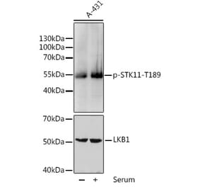 Western Blot - Anti-LKB1 (phospho Thr189) Antibody (A11079) - Antibodies.com