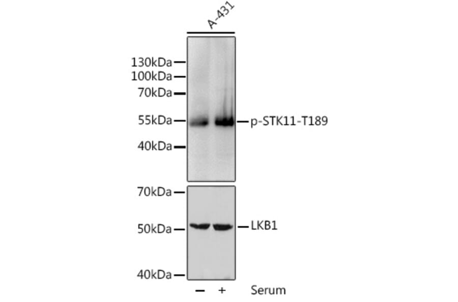 Western Blot - Anti-LKB1 (phospho Thr189) Antibody (A11079) - Antibodies.com