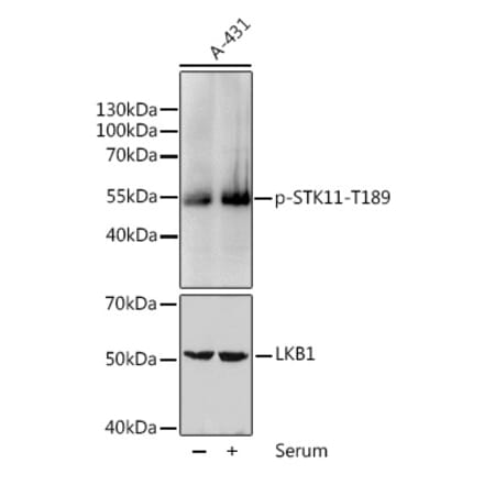 Western Blot - Anti-LKB1 (phospho Thr189) Antibody (A11079) - Antibodies.com