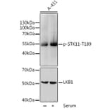 Western Blot - Anti-LKB1 (phospho Thr189) Antibody (A11079) - Antibodies.com