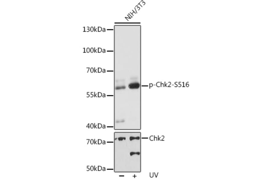 Western Blot - Anti-Chk2 (phospho Ser516) Antibody (A11080) - Antibodies.com