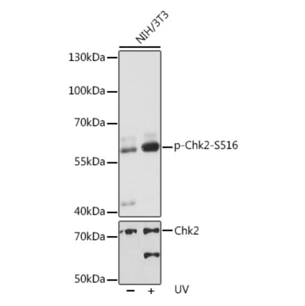 Western Blot - Anti-Chk2 (phospho Ser516) Antibody (A11080) - Antibodies.com