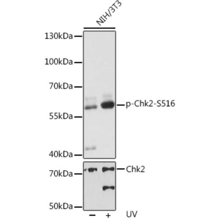 Western Blot - Anti-Chk2 (phospho Ser516) Antibody (A11080) - Antibodies.com