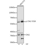 Western Blot - Anti-Chk2 (phospho Ser516) Antibody (A11080) - Antibodies.com
