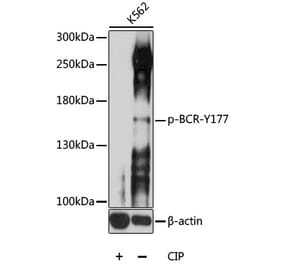 Western Blot - Anti-Bcr (phospho Tyr177) Antibody (A11082) - Antibodies.com