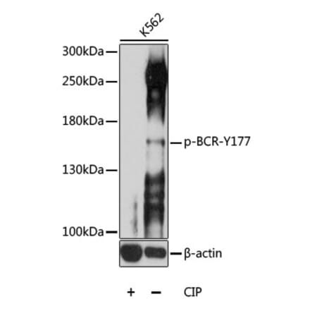 Western Blot - Anti-Bcr (phospho Tyr177) Antibody (A11082) - Antibodies.com