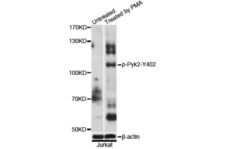 Western Blot - Anti-Pyk2 (phospho Y402) Antibody (AP0612) - Antibodies.com