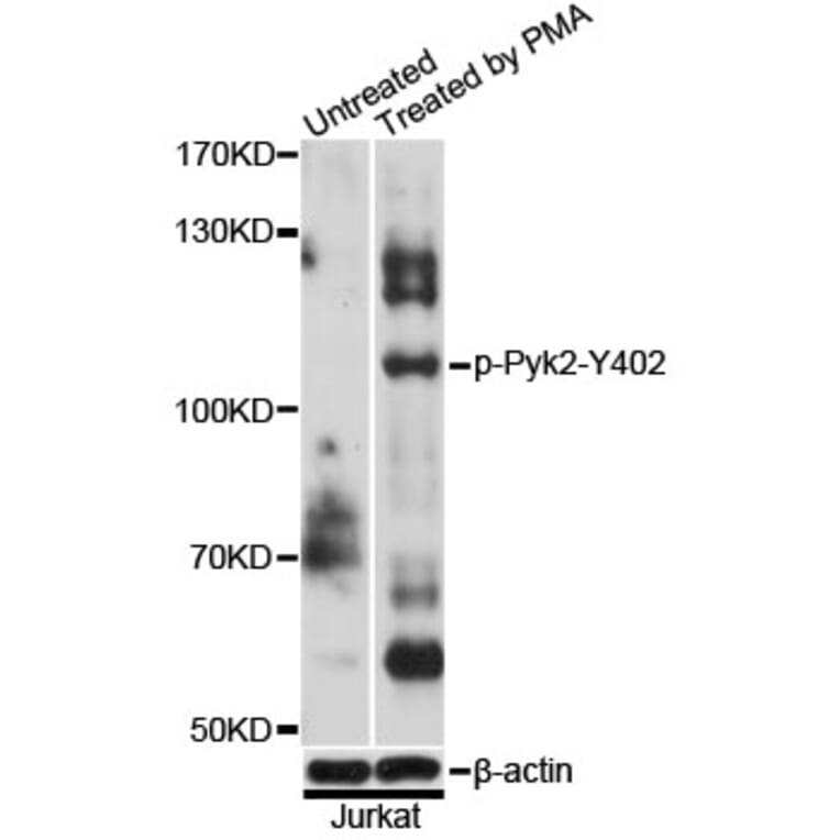 Western Blot - Anti-Pyk2 (phospho Y402) Antibody (AP0612) - Antibodies.com
