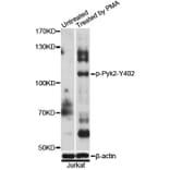 Western Blot - Anti-Pyk2 (phospho Y402) Antibody (AP0612) - Antibodies.com