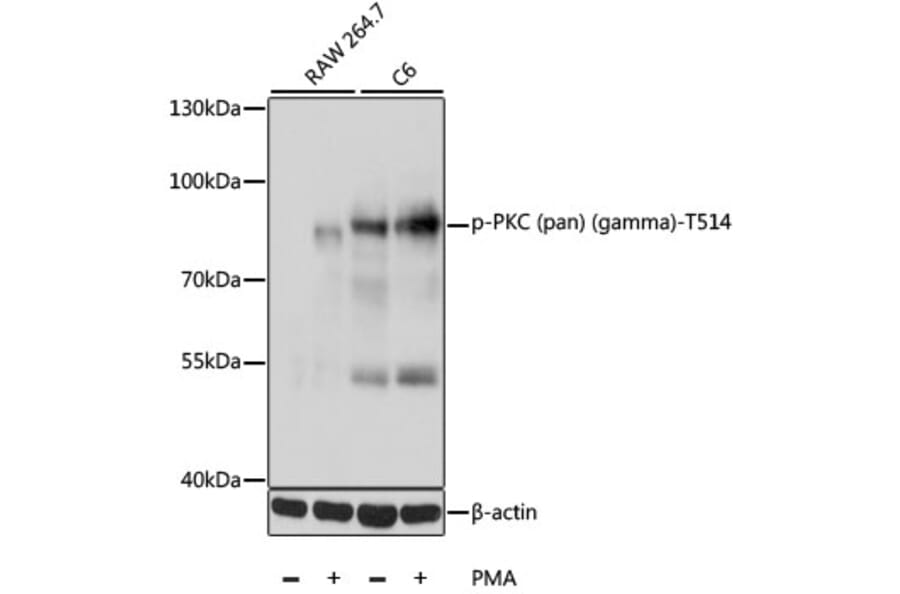 Western Blot - Anti-pan PKC (phospho Thr514) Antibody (A11089) - Antibodies.com