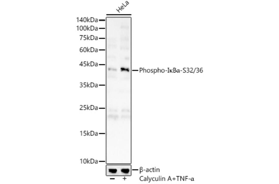 Western Blot - Anti-IKB alpha (phospho Ser32 + Ser36) Antibody (A11090) - Antibodies.com
