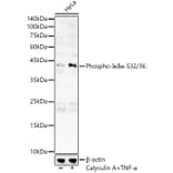 Western Blot - Anti-IKB alpha (phospho Ser32 + Ser36) Antibody (A11090) - Antibodies.com