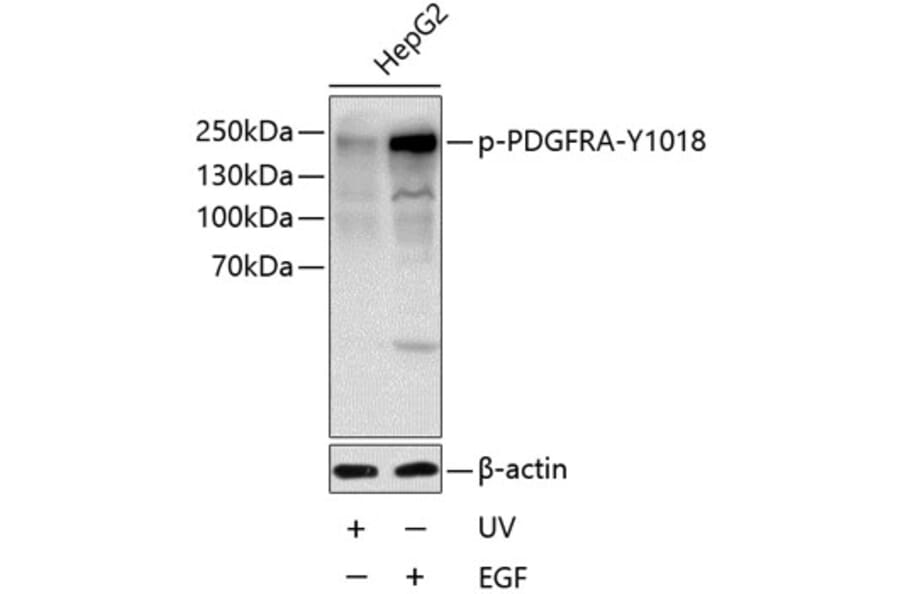 Western Blot - Anti-PDGFR alpha (Phospho Y1018) Antibody (A11091) - Antibodies.com
