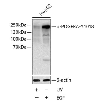 Western Blot - Anti-PDGFR alpha (Phospho Y1018) Antibody (A11091) - Antibodies.com