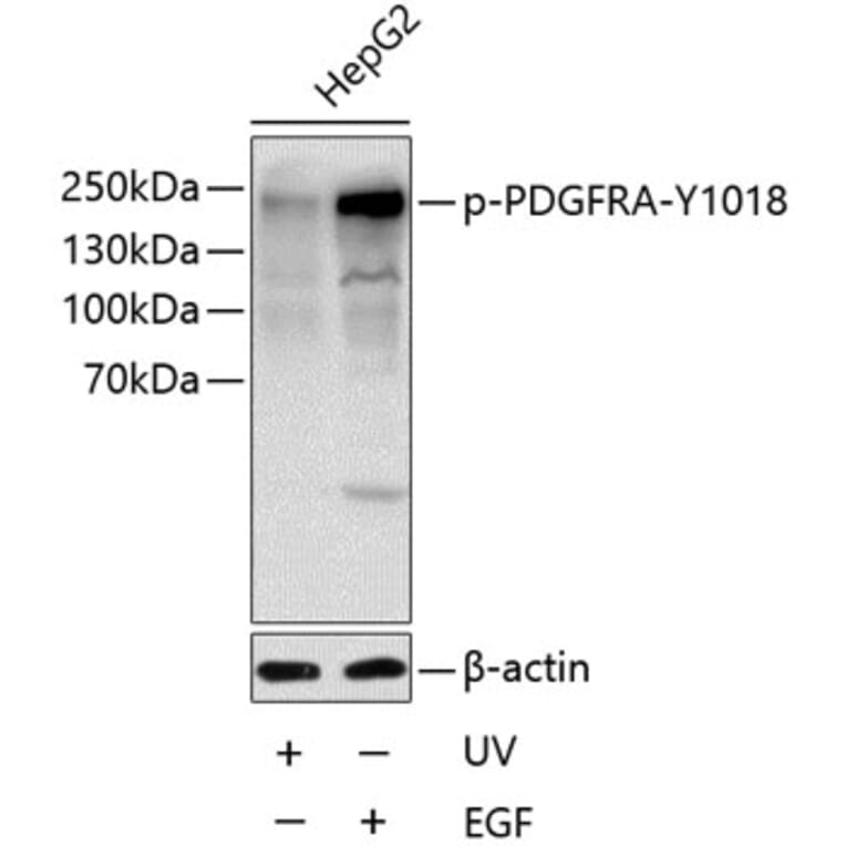 Western Blot - Anti-PDGFR alpha (Phospho Y1018) Antibody (A11091) - Antibodies.com